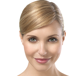 facelift
