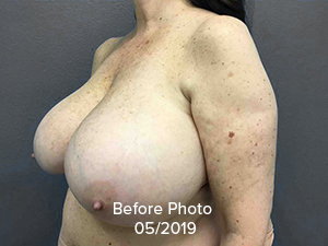 90183-5of10