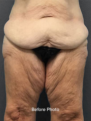 6577