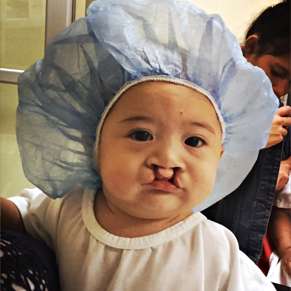 Dr. Lentz Mission Work in Honduras 38