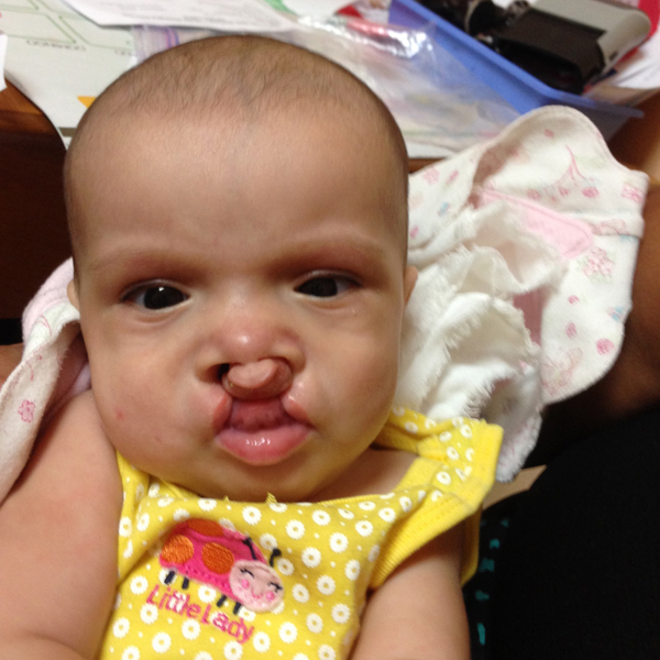 Dr. Lentz Mission Work in Honduras 57