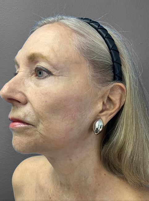 Profile view of a mature woman showcasing natural beauty and elegance.