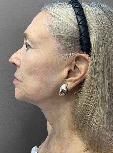 Profile view of mature woman showcasing natural beauty and elegance.