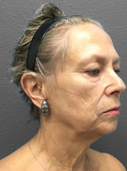 Profile view of a mature woman showcasing natural beauty and elegance.