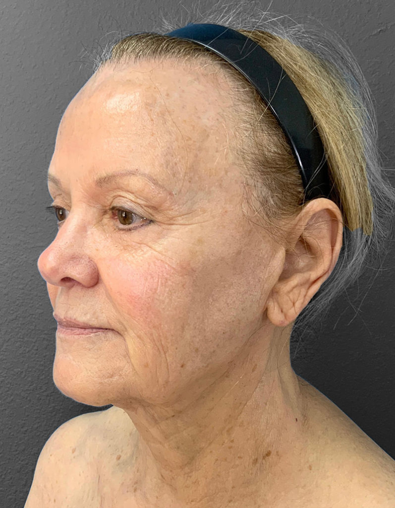 Patient profile showcasing natural results post-plastic surgery consultation.