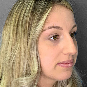 Patient consultation highlighting natural beauty and professional care at Lentz Plastic Surgery.