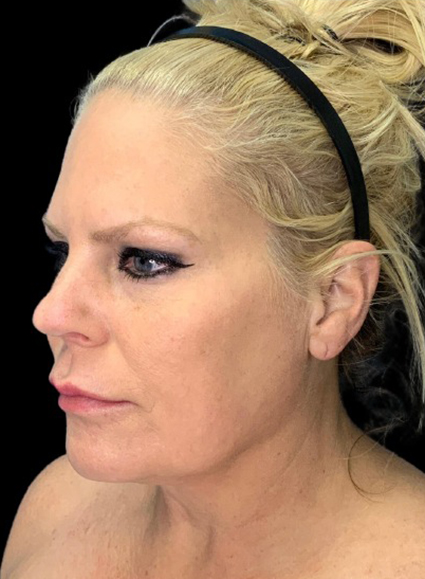 Profile view of a woman showcasing natural beauty and refined features.