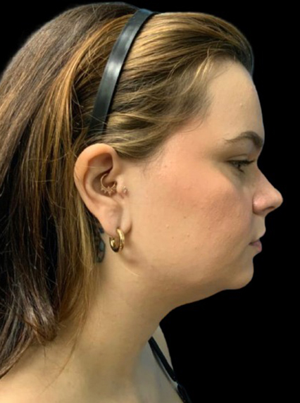 Profile view of a woman showcasing refined facial contours and earrings.
