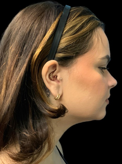 Profile view of a woman showcasing elegant ear piercings and healthy skin.