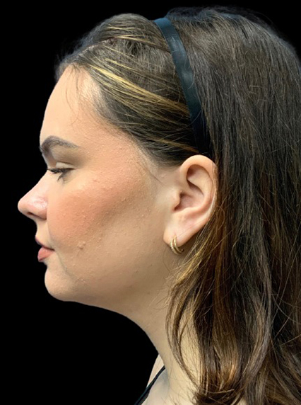 Profile view of a woman highlighting facial contours and natural beauty.