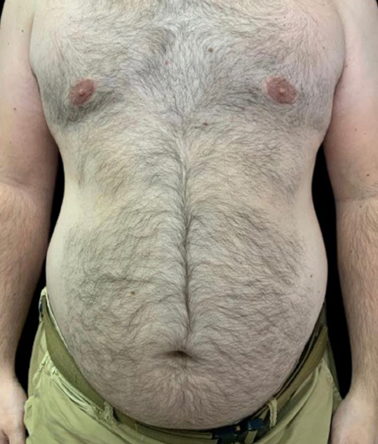 27820
