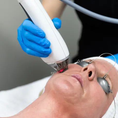 Moxi Laser